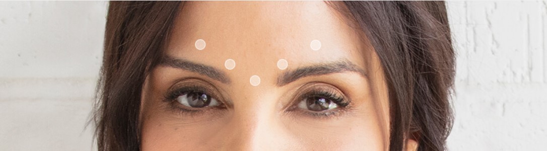 Woman's forehead demonstrating dysports five points of treatable areas in the forehead.